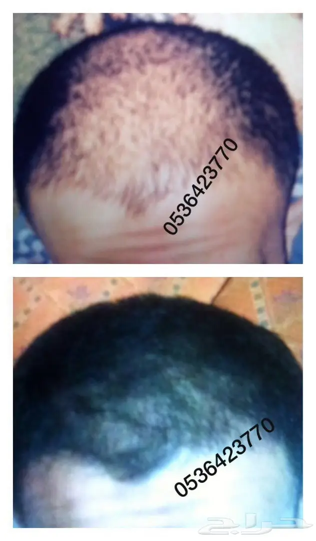 طريقه ممتازه ومجربه لتكثيف الشعر (image 9)