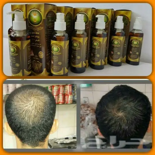 زيت ملك الزيوت (image 3)