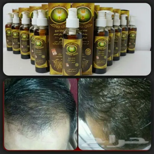 زيت ملك الزيوت (image 5)
