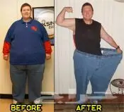 وداعا للتكميم وقص المعده وداعا للسمنه ف21يوم