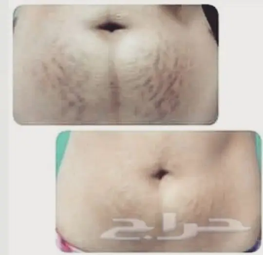 مقشر أمريكي طبيعي لبشرة أكثر نضارة وإشراقًا! (image 9)