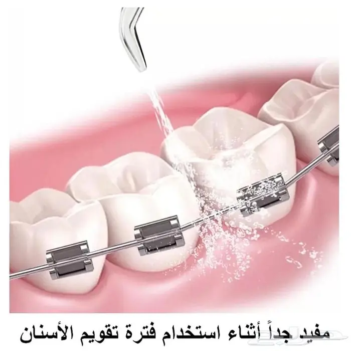 جهاز تنظيف الأسنان بقوة ضغط الماء مع الشحن 1