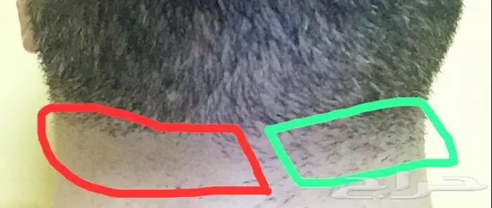 ماكينة تنعيم دقن 9