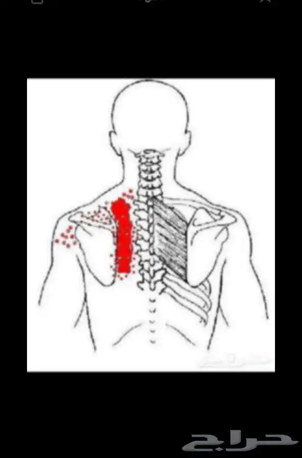 التخلص من الابهر 7