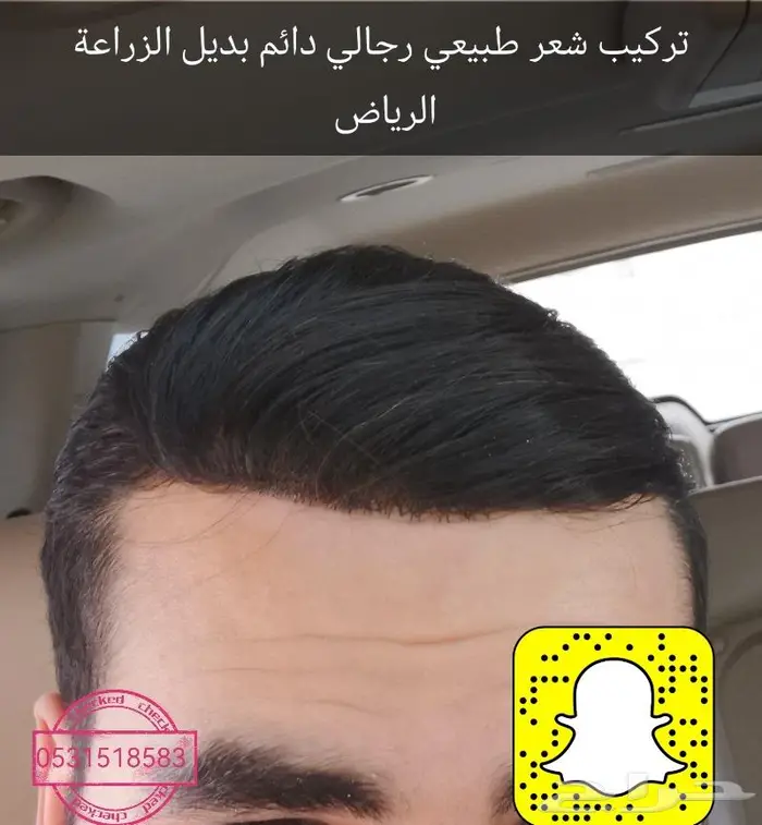 لصق شعر رجالي طبيعي 4
