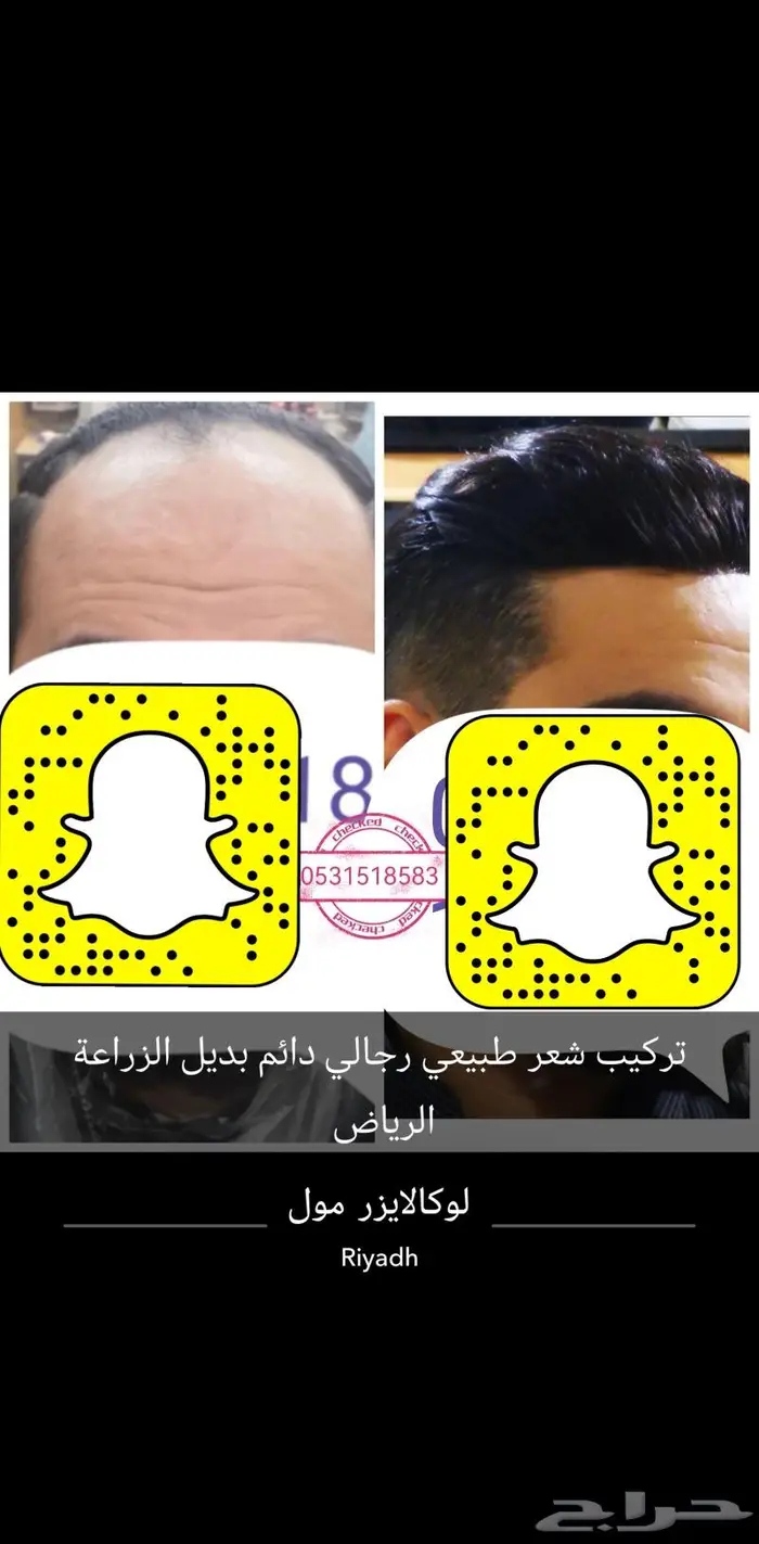 بوستيجه باروكة 6