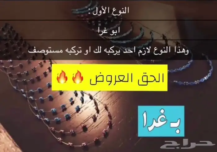 تقويم أسنان زينة 1