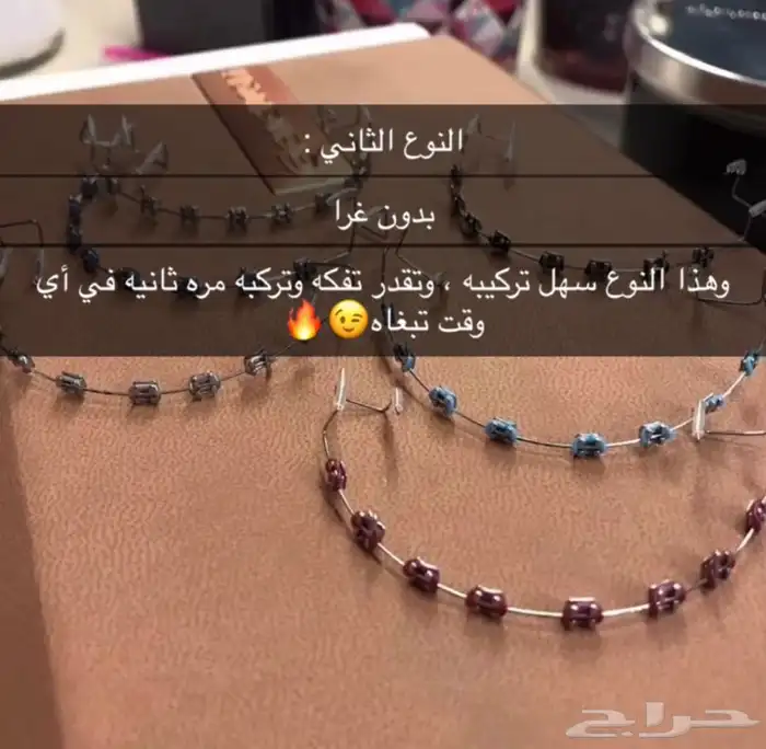 تقويم أسنان زينة 2