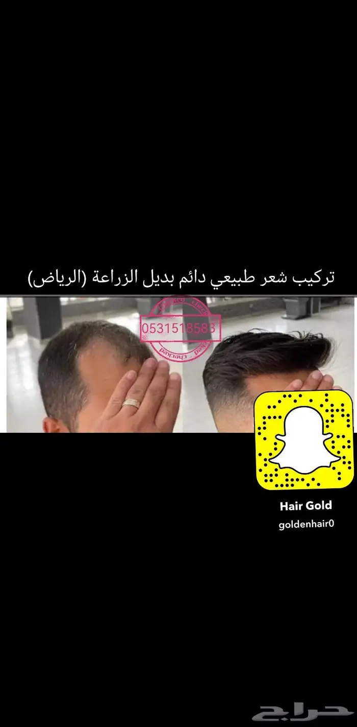 بوستيجه تركيب شعر لصق او كلبسات 3