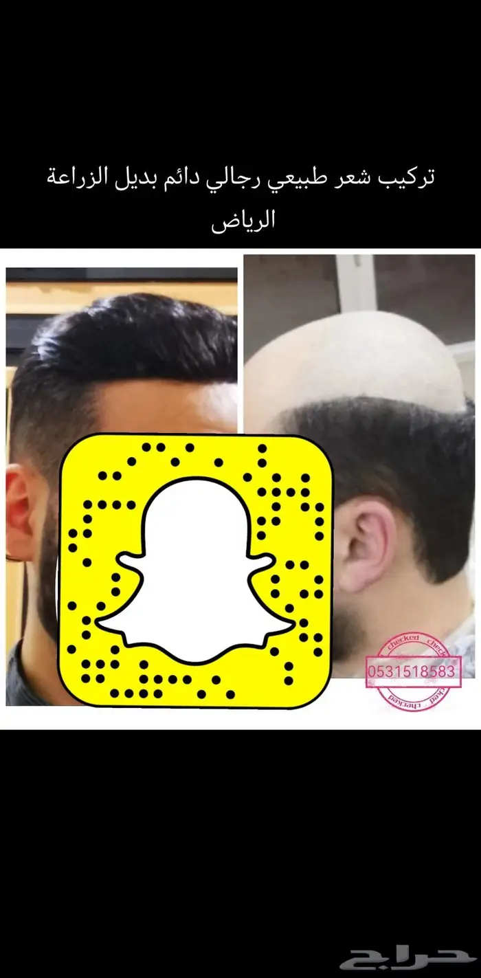 بوستيجه تركيب شعر لصق او كلبسات 0