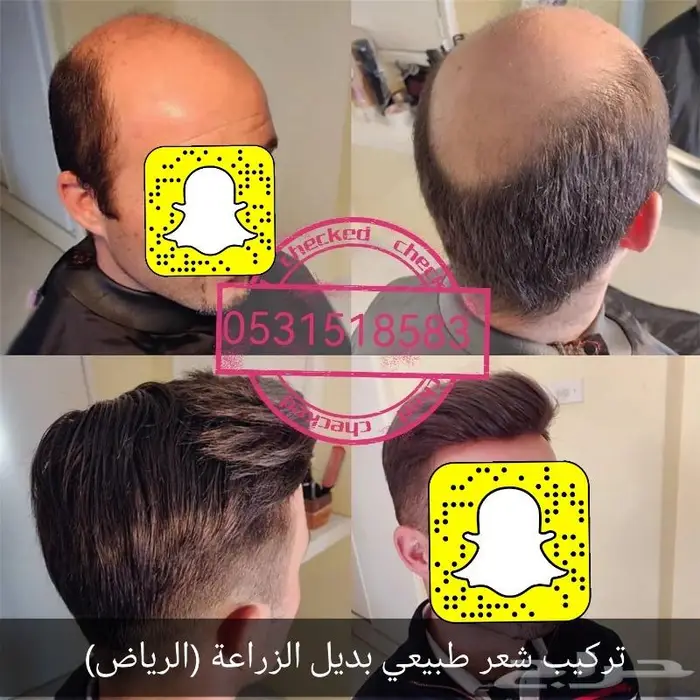 بوستيجه تركيب شعر لصق او كلبسات 2