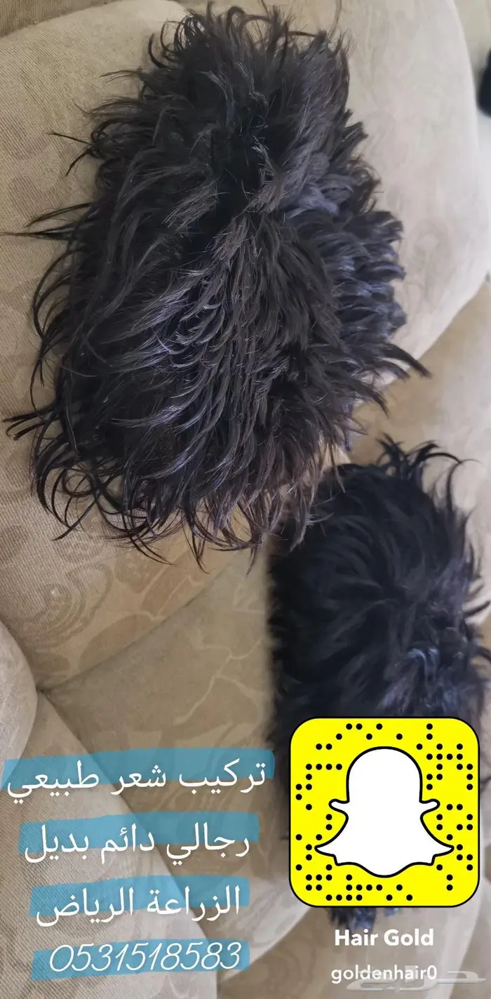 بوستيجه للصلع بديل للزراعة 9