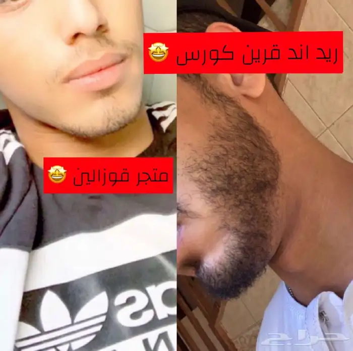 زيت ينبت الشعر والدقن ويعالج مشاكل الشعر ويكثف الدقن 1