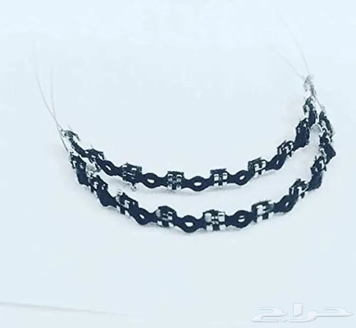تقويم اسنان زينه 0