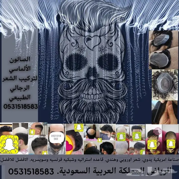 تركيب بوستيجه دائم بديل الزراعة 8