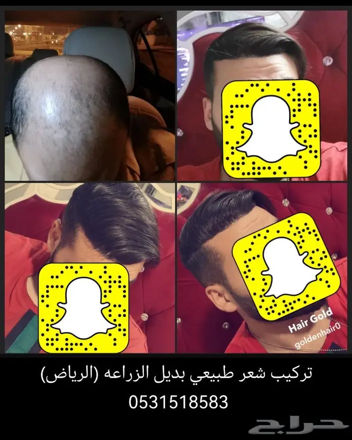 تركيب شعر بشري دائم طبيعي بوستيجه 11