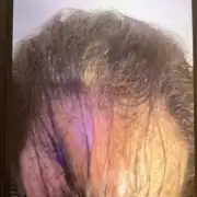 باروكه للرجال تركيب شعر 5