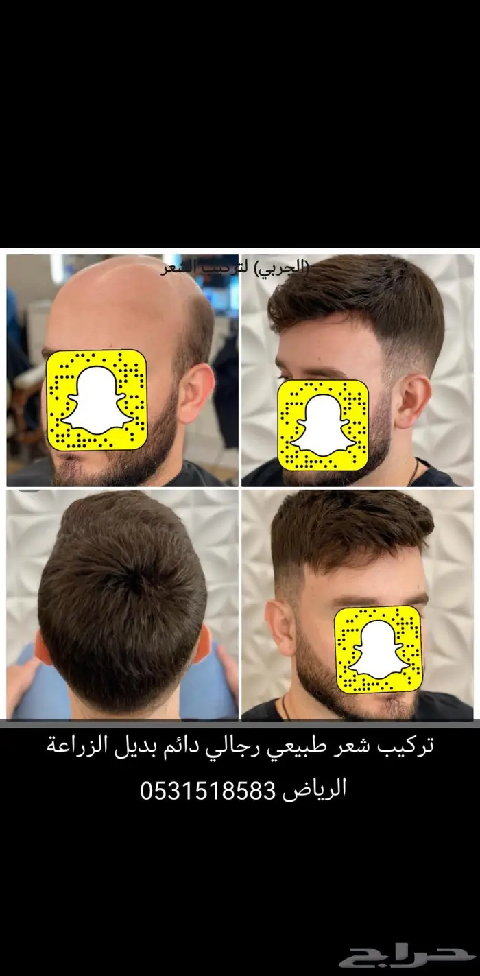 بديل الزراعه لصق شعر طبيعي دائم 4