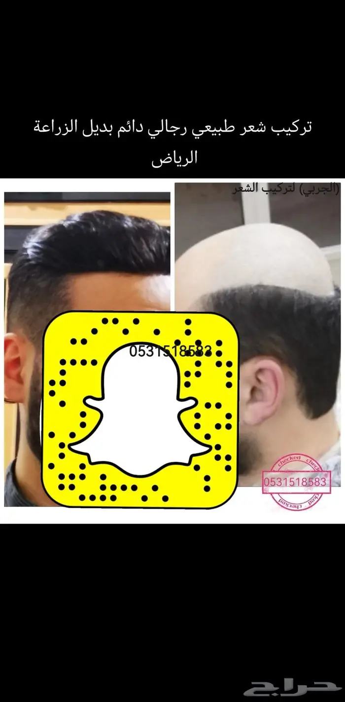 بديل الزراعه لصق شعر طبيعي دائم 12