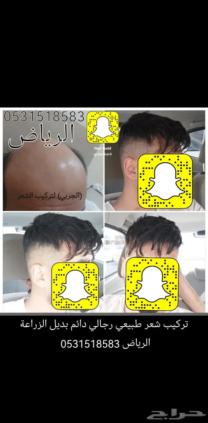 تركيب شعر دائم اوروبي وبرازيلي طبيعي 3