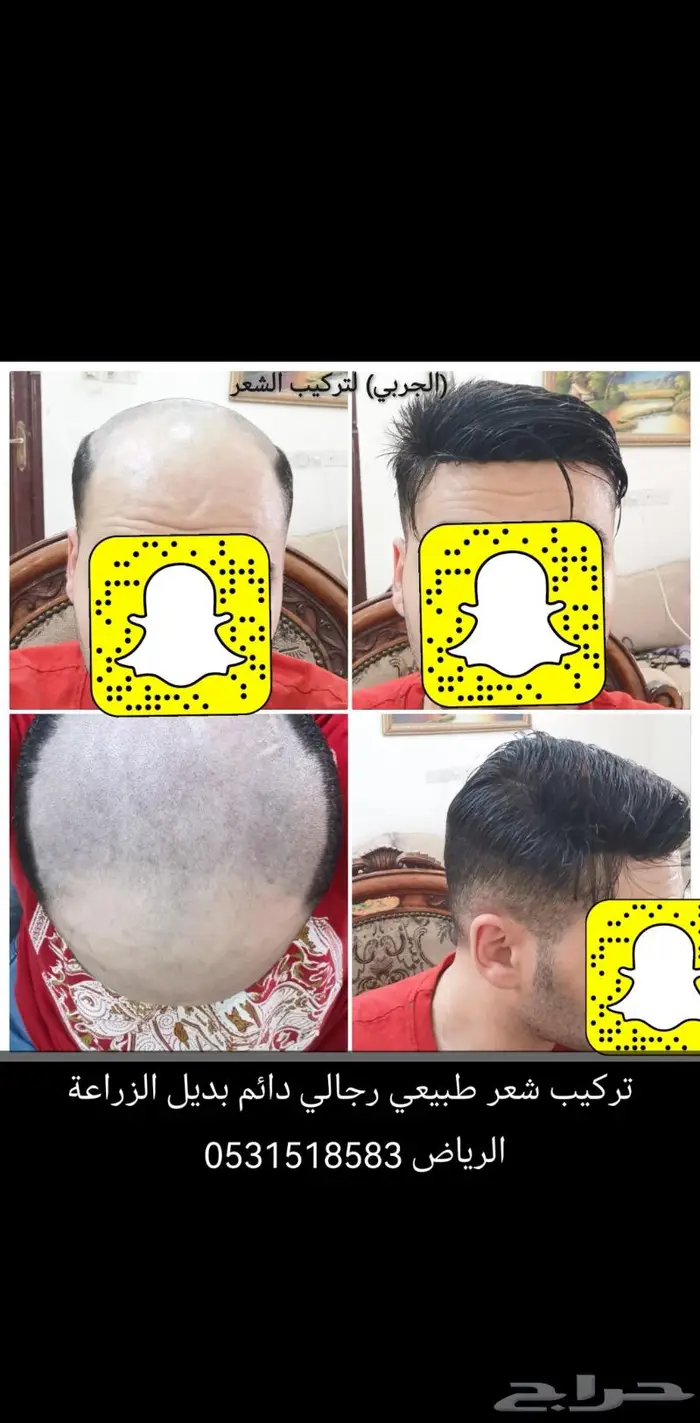 تركيب شعر دائم اوروبي وبرازيلي طبيعي 4