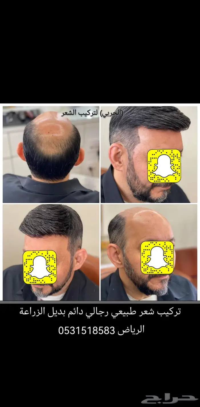 تركيب شعر دائم اوروبي وبرازيلي طبيعي 7