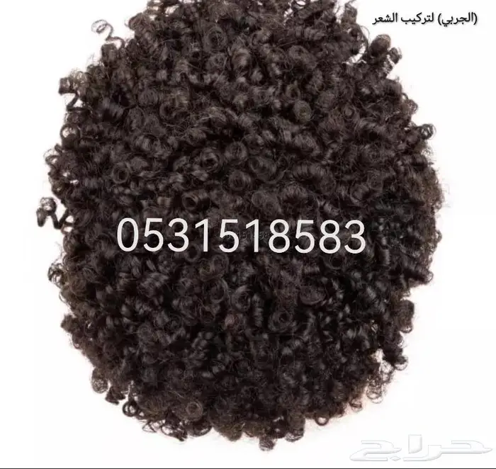 حل الصلع الدائم بديل الزراعة 16