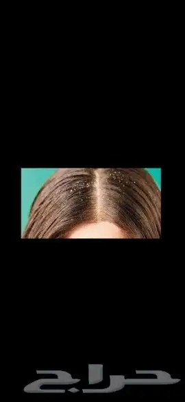 منتج ممتاز للشعر 18