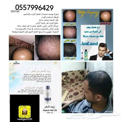 منتج ممتاز للشعر 41