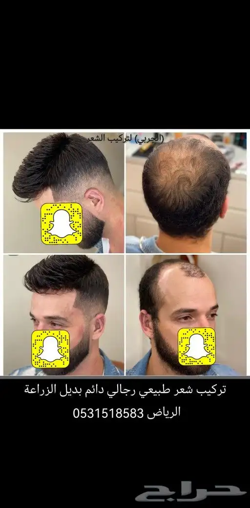 تركيب شعر طبيعي لصق اصلي 7