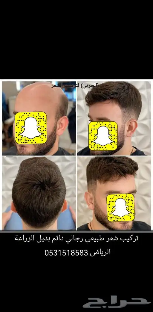 تركيب شعر طبيعي لصق اصلي 0