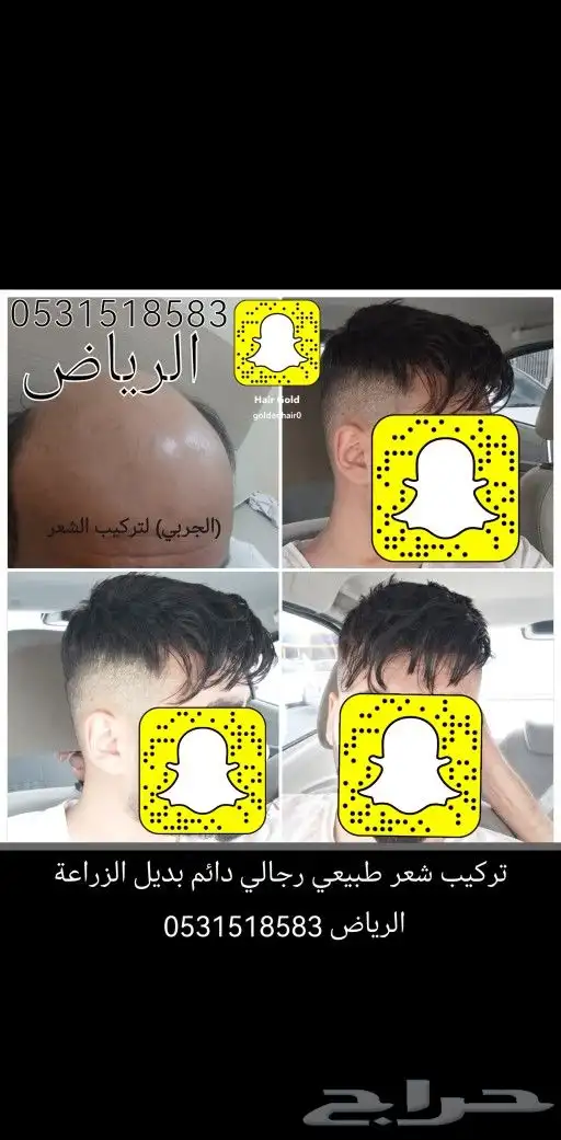 تركيب شعر طبيعي لصق اصلي 13