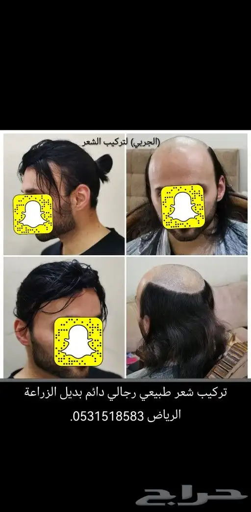 تركيب شعر طبيعي لصق اصلي 1