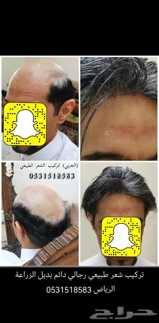 تركيب شعر طبيعي لصق اصلي 16