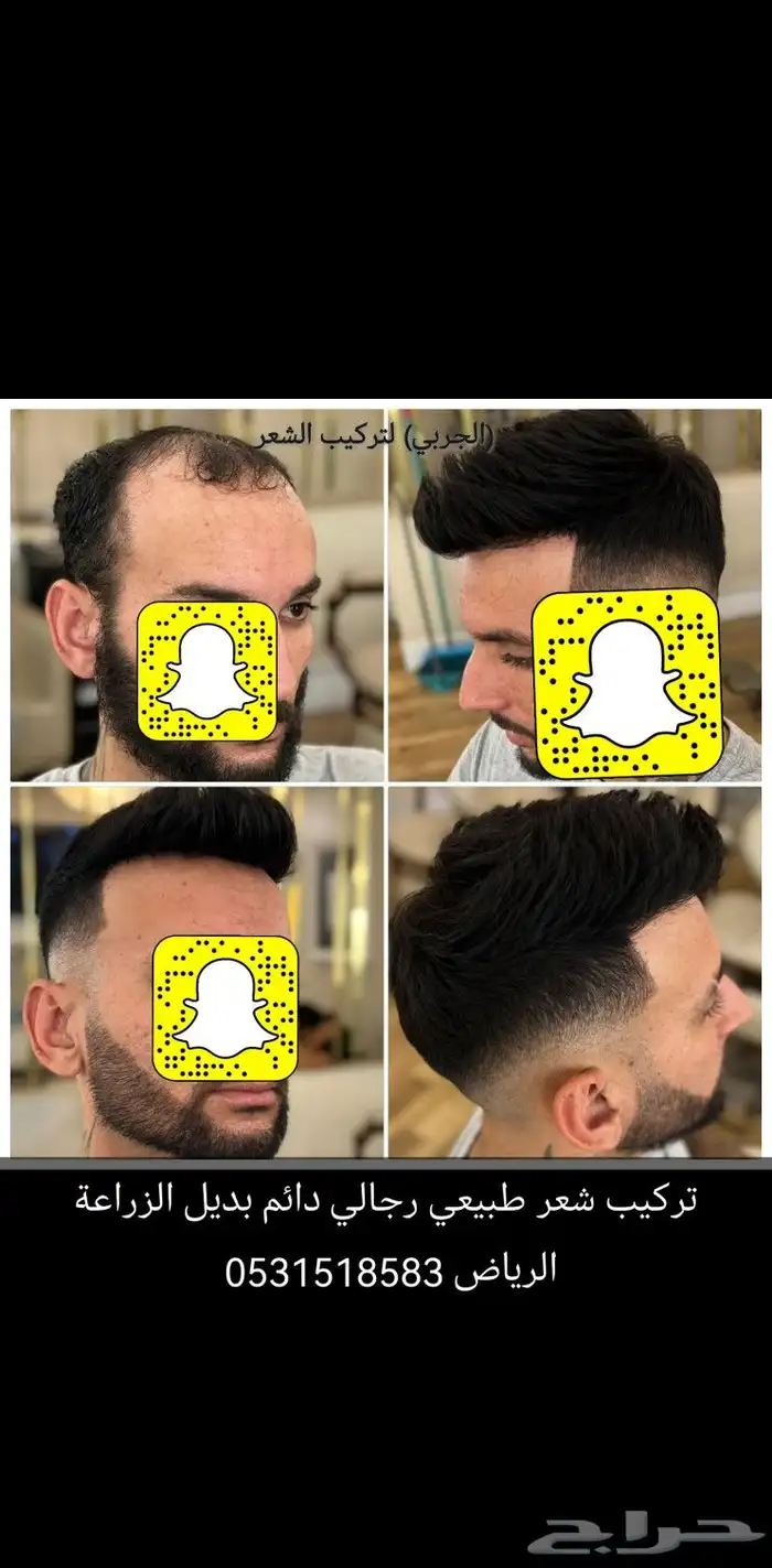 تركيب شعر طبيعي لصق اصلي 6