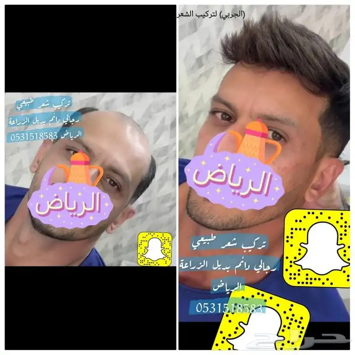 تركيب شعر طبيعي لصق اصلي 12