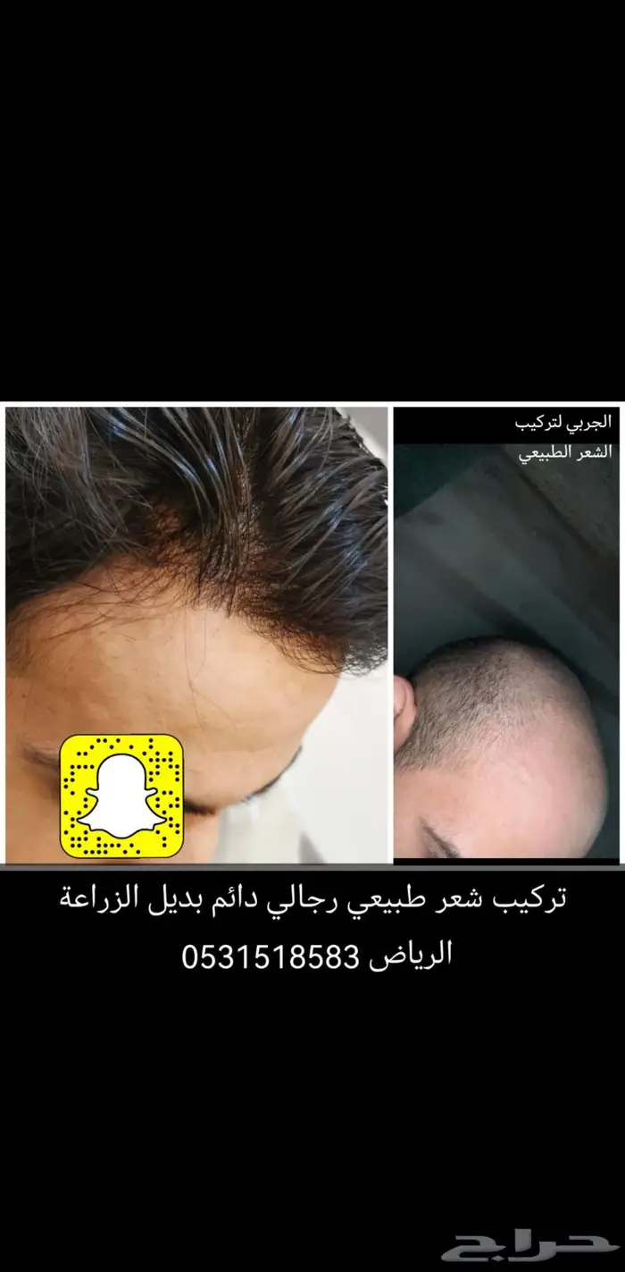 لصق شعر رجالي طبيعي 5