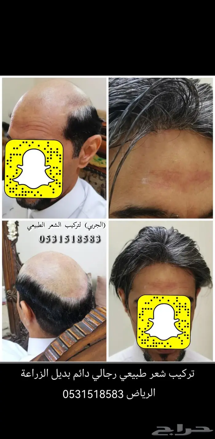 لصق شعر رجالي طبيعي 17