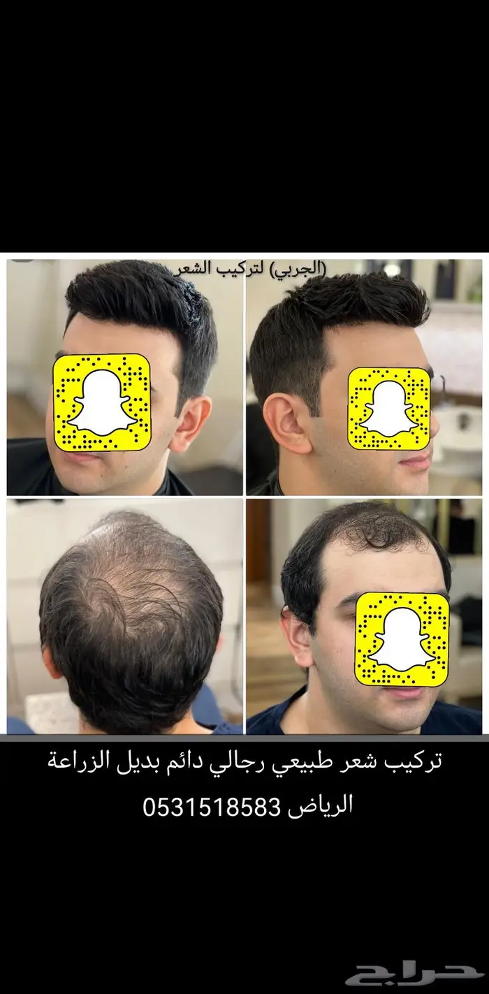 لصق شعر رجالي طبيعي 27
