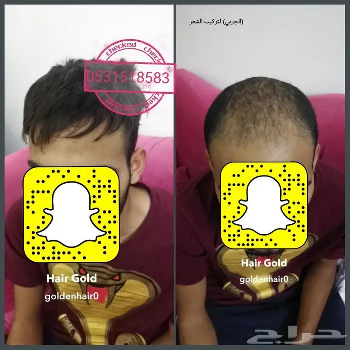 لصق شعر رجالي طبيعي 18