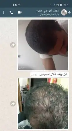 منتج ممتاز للشعر جرب وانت الحكم 33