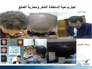 منتج ممتاز للشعر جرب وانت الحكم 13
