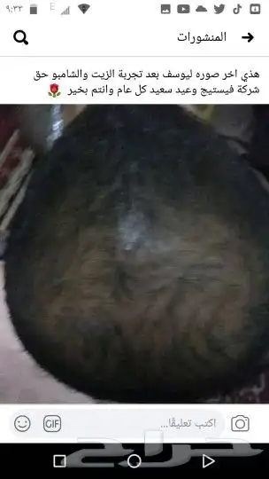 منتج ممتاز للشعر جرب وانت الحكم 47