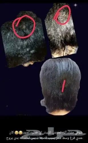 منتج ممتاز للشعر جرب وانت الحكم 45