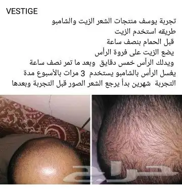 منتج ممتاز للشعر جرب وانت الحكم 46