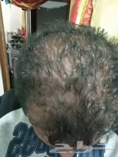 منتج ممتاز للشعر جرب وانت الحكم 30