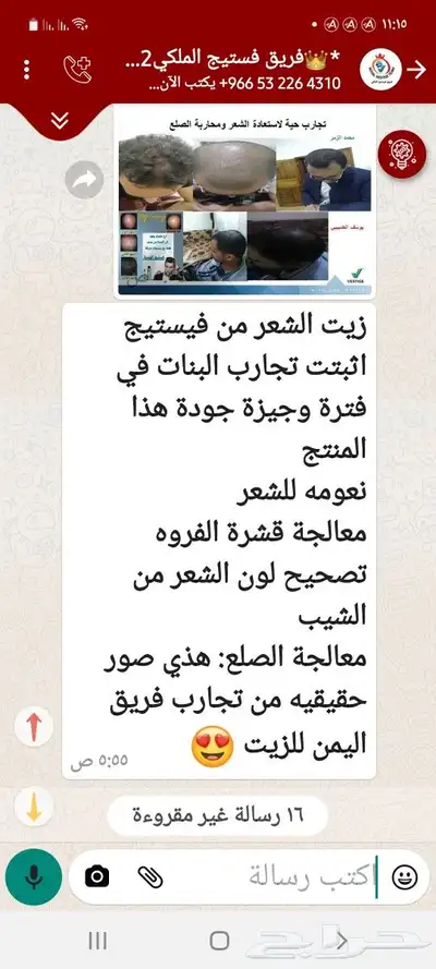 منتج ممتاز للشعر جرب وانت الحكم 36