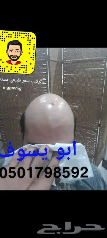 تركيب يونت باروكه شعر طبيعي المستعار لرجال 10