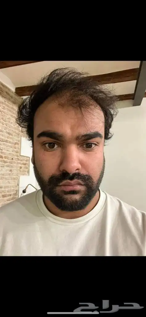 تركيب يونت باروكه شعر طبيعي المستعار لرجال 27