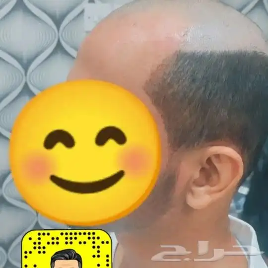 يونت تركيب شعر طبيعي للرجال 0